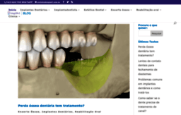 implantesorais.com.br