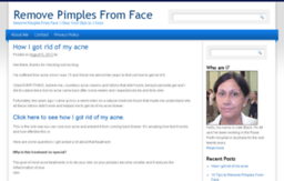 removepimplesfromface.com
