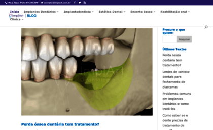 implantesorais.com.br