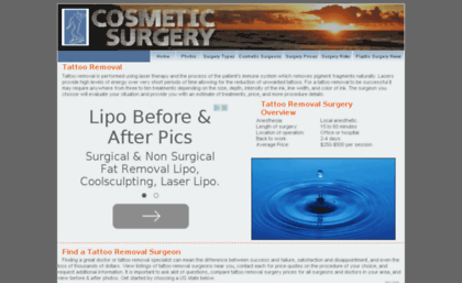 tattoo-removal.cosmeticsurgeryprocedure.com